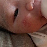 宝宝脸上长的啥