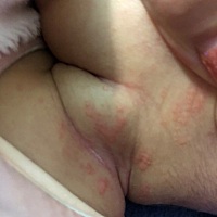 有没有宝妈知道这是长的什么，只有脖子才有，要用什么药，求告知