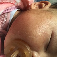 看着都心疼脸蛋花成这样，心塞，有没宝妈知道是怎么回事？