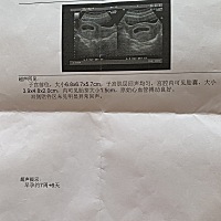 二胎想看看能不能凑个好字，男孩女孩啊