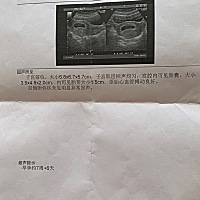 二胎猜一下男孩女孩