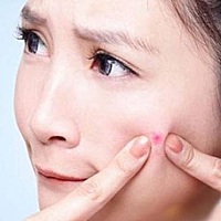 产后脸上长痘长斑是很正常的现象，是因为荷尔蒙分泌的变化和不断增加的疲劳所引起的。所以产后爱美妈妈...