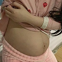 第三天，这个刀口好像还不错哈？？这肚子啥时候才能消下去呀🤣🤣🤣