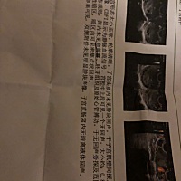 怀孕47天的做的检查结果单，医生说不排除宫外孕，吓死了