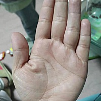 碰到一个短命的手😂😂😂