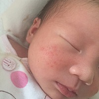 宝宝的脐带多久掉属于正常呢？我家宝宝的还没有掉的感觉   …     脸上起的疹子是热的吗😳