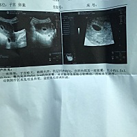 首次b超～