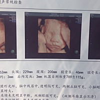 亲爱的小猪猪出生后跟四维图的对比