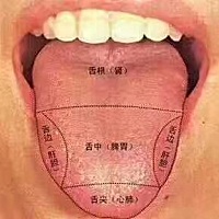 孩子舌头上老是有一块一块的白块，这时候家长千万不要掉以轻心！这是地图舌，地图舌病在脾胃。 引起地图...