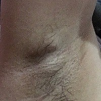 产后第六天发现腋窝下有两粒硬块，不摸它也没有感觉疼痛，六天了因为感冒不敢喂奶，每天都用吸奶器吸，...