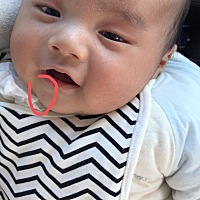是否需要去医院检查