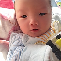 宝宝出生11天了  还是有点黄疸
