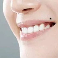 嘴角有痣的人，贪财好色，但虽然贪财，却得财不易，守财难坚持。因为好吃，贪图物质享受，所以存不住钱。