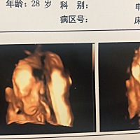 最初怀孕时候，很希望他是个女儿，感觉女孩子比较乖巧，听话，还有希望复刻一下他爸爸的长相，后来知道...