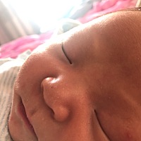 宝宝鼻头上的白点点什么原因啊