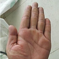 辛苦得财的手型。事业线起端较为杂乱，早年运势不是很好，过得比较辛苦，到中年会有所改善。感情线平直...