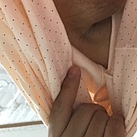 剖腹产后一周，腰酸背痛，躺着就起不来，舌干口燥，最要命的是副乳疼得整夜睡不了，喂奶乳头也疼，救命...