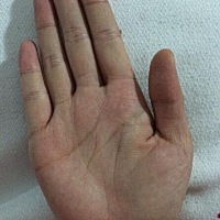 感情线延伸至中指食指之间，感情易追求浪漫并且比较固执，最少得经历四段感情才能修成正果。