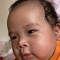 满脸摸起来很粗糙，下巴脖子更严重，太愁人了，帮忙看看这皮肤到底是咋回事😭三个月大