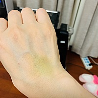 回到家已千穿百孔，做妈妈真的不容易，两个手的手指经历了上百次的扎针（血糖高），脊椎的麻药针孔用胶...