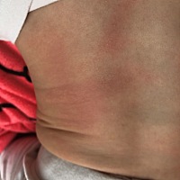 宝妈们，谁知道我家宝宝这身上怎么了