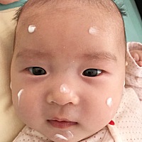 我都快愁死了，湿疹到底应该怎么办，过敏原也查了，奶粉也换了，从满月到现在一岁了，反反复复，医院只...