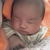 想请问下大家 我对美容线排异 满月三十天了 发现会阴的美容线浮出来了 不疼 就是酸酸的 需要去医院拆线...