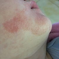 请问各位宝妈们，宝宝皮肤这是什么状况呀，擦什么可修护呀？？？