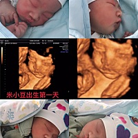 四维出来担心死我了，怎么这么丑的小孩