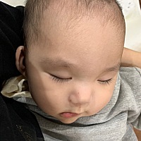 最近我妈和老公说宝宝的眼距有点宽，我看了确实也是有点宽，然后我就去百度了一下，结果没把自己吓惨了...