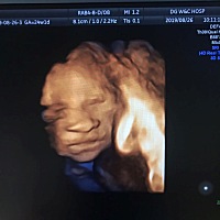 肚子里 、出生第一天、第二天、第四天、18天  今天是第25  生出来丑 在养养 万一变好看了呢😂