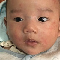 有哪个宝妈知道宝宝长的这些是什么？求解 有什么有效的方法治，麻烦看到的宝妈知道方法，麻烦讲解谢谢。
