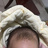 怀孕管家圈的宝妈们！我想请问下，你们有见过宝宝骨缝重叠的吗？就是宝宝头部有一圈骨头重叠凸出来的，...