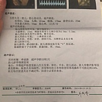 大家帮忙看看是男孩还是女孩啊，快生啦，有点好奇