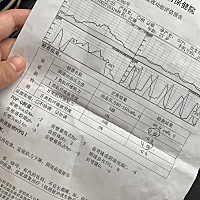 产后42天去检查，盆底肌肌力二级，医院要我做产后修复，说是三级合格，二级自我恢复不起来，好像是用电...