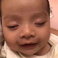 宝宝3个多月了，昨天偶然摸到宝宝耳朵后边有一个小鼓包，会移位，不知道是啥。不知道痛不痛😭求助大家...