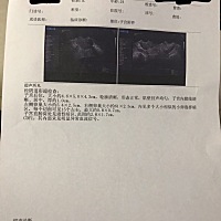 多囊卵巢怎么办？？？？