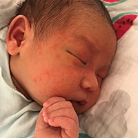 宝宝出生半个月了，前几天脸上起了湿疹，家里温度不高，19度，也没有穿厚衣服，盖的也不多，算是比较注...