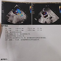 带孩子去体检，医生说心脏有杂音，吓唬我，让我带孩子去外面大医院找专家看，果断做了个彩超。下午没有...