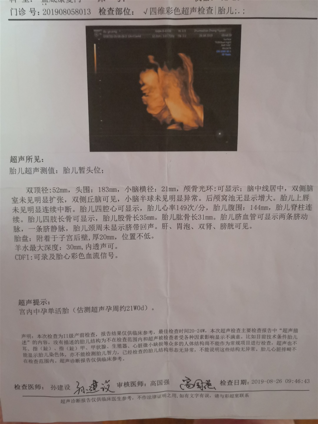 四维做的比较早，感觉和四维好像，这姿势摆的！