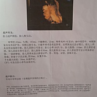 宝宝出生那一刻。宝妈都是啥感觉？？ 我先说吧。其实没有很感动吧。累都累死了。 第一感觉就是。。我了...