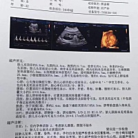 跪求了  弟媳的检查单子   俩人要孩子不容易   有没有可能是误诊