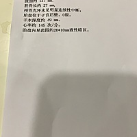 心累，怀孕带娃