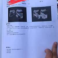 怀孕7周，医生说点空囊，你们说还有没有机会能长出胎芽。