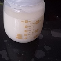 你们侧切伤口多久好的