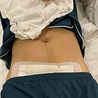 孕期长20多斤，来个8斤的乔治宝宝，生完36小时的肚子，妊娠线，松弛的肚脐！啥时候能恢复。