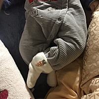 我们家宝宝现在五个多月了 抱他站起来 左腿总是伸不直脚碰不到地 一个月零几天时候就去医院做B超说没事 ...