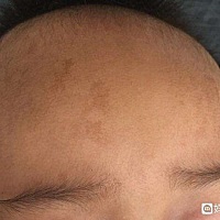 好担心啊，。。。希望有经验的宝妈帮我一下。谢谢