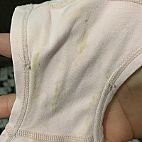 有谁能告诉我，什么情况，没有说下体不舒服