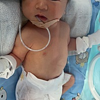 1.30 中午11点生下了他 无侧切 轻微撕裂 五斤男宝 不过还放在保温箱里